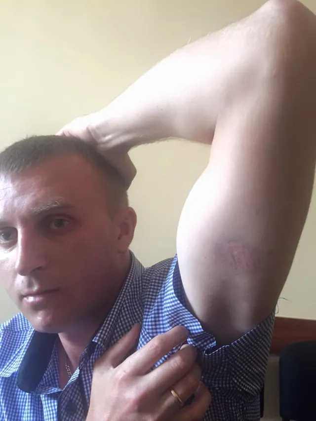 Начальник патрульной полиции города Дмитрий Михалец избил ветерана АТО, который прошел Иловайск. Михалец прокомментировал данную ситуацию — фото 1